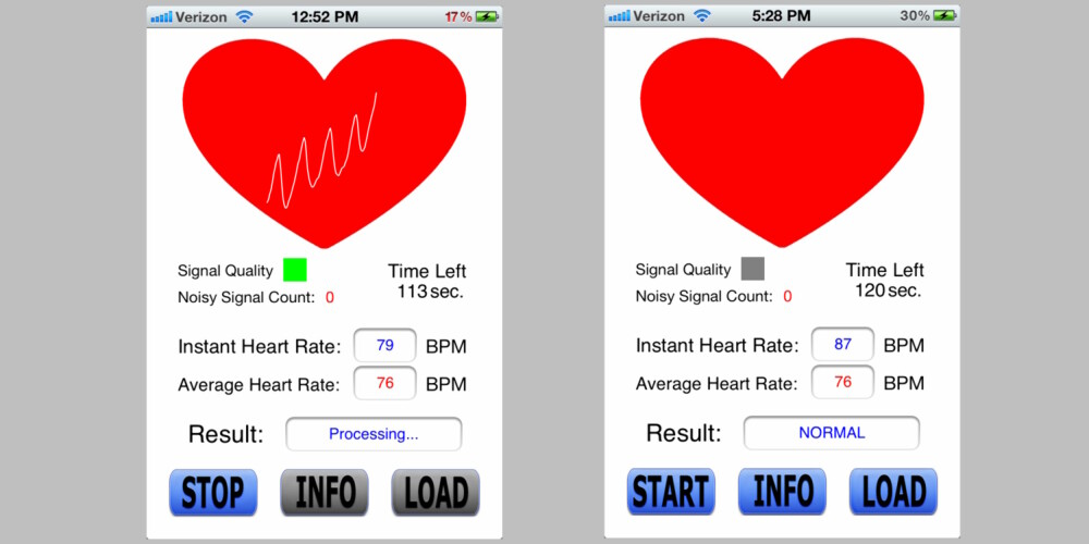GRENSESNITTET: Slik ser appen ut. Bildet til venstre viser appen mens den scanner hjertefrekvensen din. På bildet til høyre er resultatet ferdig, og i dette tilfellet viser det normal hjertefrekvens.