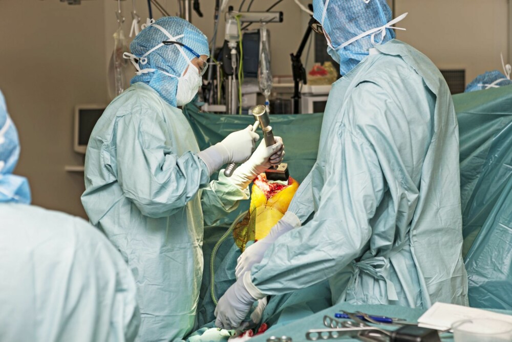 6. HAMMER OG DOR: Med en spesialhammer bankes prøveprotesene på plass etter at lårbenet er kuttet i riktig vinkel. Prøvingen og tilpassing av deler er den mest tidkrevende jobben av en kneproteseoperasjon.