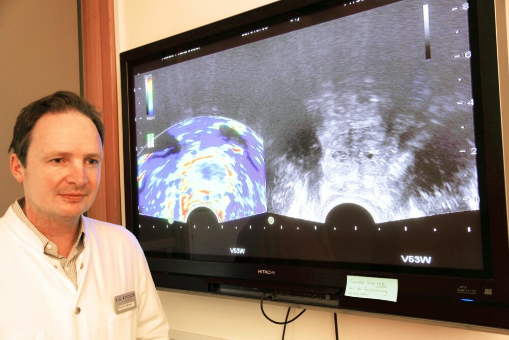 ELASTOGRAFI: Her driver professor Dr. Georg Salomon med elastografi ved Maritini-Klinik i Hamburg, et av verdens aller fremste sykehus for behandling av prostata-kreft. ELASTOGRAFI: Her driver professor Dr. Georg Salomon med elastografi ved Maritini-Klinik i Hamburg, et av verdens aller fremste sykehus for behandling av prostata-kreft.