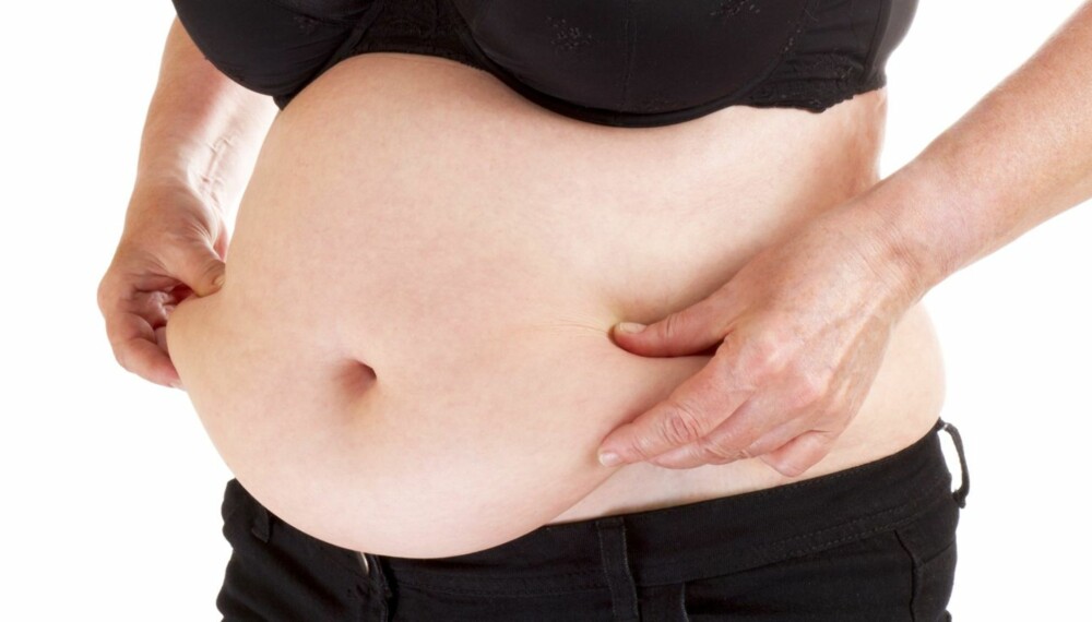 OVERFLØDIG HUD: Normalvektige pasienter med noen uønskede fettansamlinger i flankene og på magen vil få et bedre resultat av plastisk kirurgi enn de som fortsatt er overvektige.