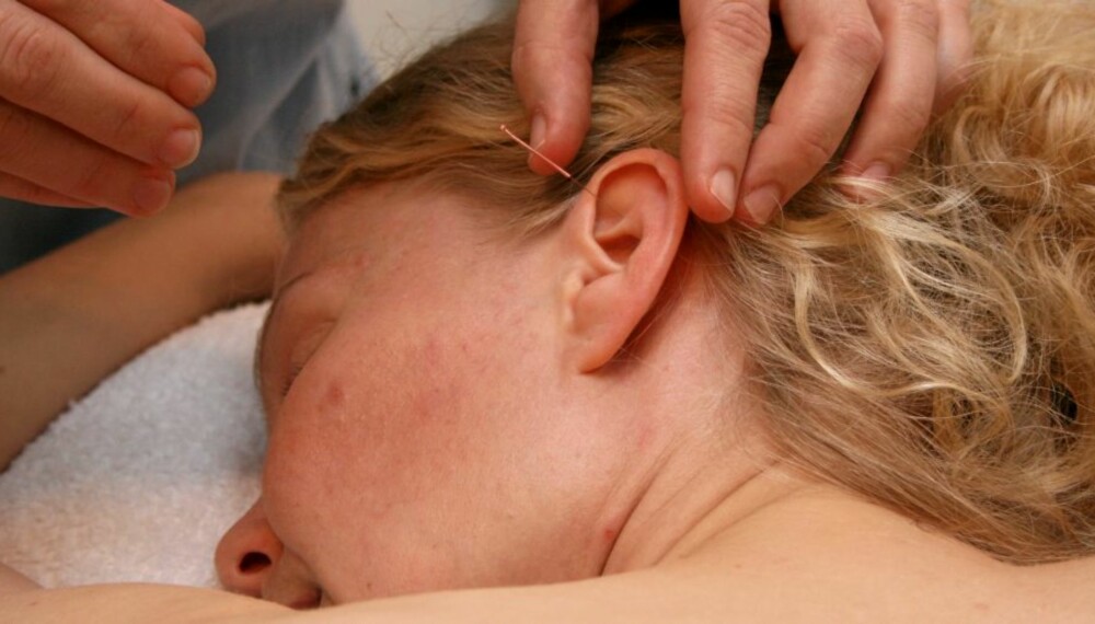 HULL I ØRET: En nål i øret skal hjelpe mot søvnproblemer, og akkurat det kan jo være like aktuelt etter fødselen som før.