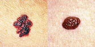 GÅ TIL LEGEN: Du bør oppsøke lege hvis du har fått et nytt symptom som ikke gir seg etter fire uker, og som føles plagsomt. Akutte smerter skal du selvsagt også søke lege for. GÅ TIL LEGEN: Du bør oppsøke lege hvis du har fått et nytt symptom som ikke gir seg etter fire uker, og som føles plagsomt. Akutte smerter skal du selvsagt også søke lege for.