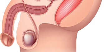 GÅ TIL LEGEN: Du bør oppsøke lege hvis du har fått et nytt symptom som ikke gir seg etter fire uker, og som føles plagsomt. Akutte smerter skal du selvsagt også søke lege for. GÅ TIL LEGEN: Du bør oppsøke lege hvis du har fått et nytt symptom som ikke gir seg etter fire uker, og som føles plagsomt. Akutte smerter skal du selvsagt også søke lege for.