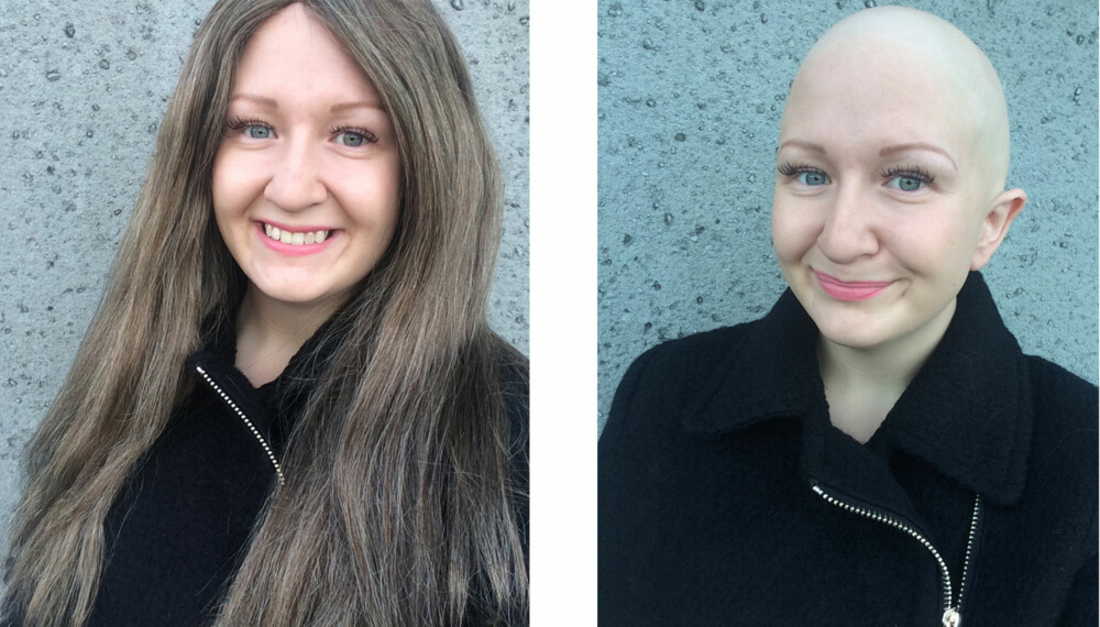 ALOPECIA: Rebecca Eilevstøl (23) forteller at det har vært veldig viktig for henne å finne positive sider ved å ikke ha hår, og i dag er det ikke lenger så vanskelig å finne dem. FOTO: Privat