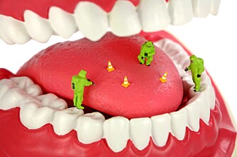 BAKTERIER: Dersom bakterier slår rot i munnen din, kan resultatet bli dårlig ånde.
