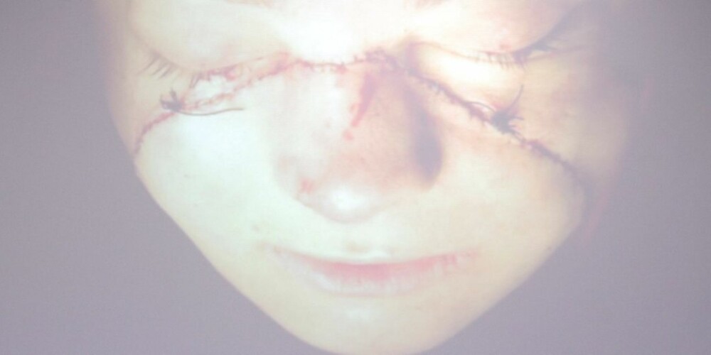 NYTT ANSIKT: Et bilde fra da Isabelle Dinoire fikk transplantert et ansikt.