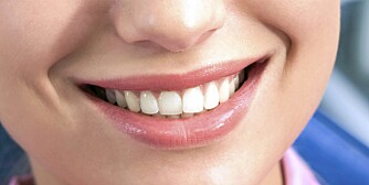 PERLERAD: Få eksperttipsene til hvordan du holder tennene dine hvite.