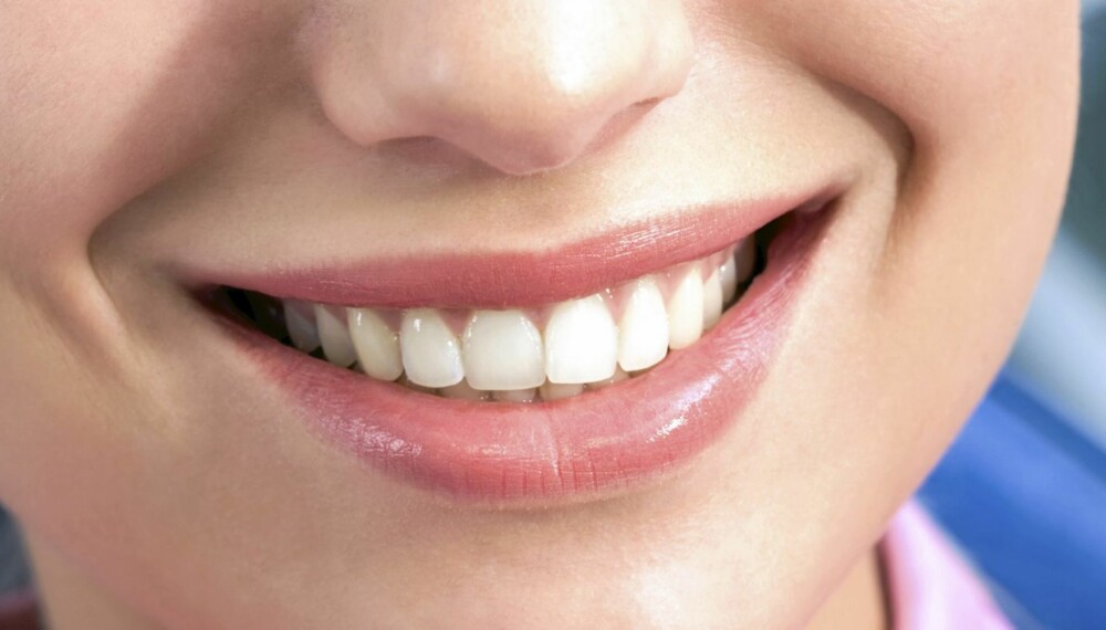 PERLERAD: Få eksperttipsene til hvordan du holder tennene dine hvite.