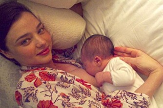 TRENDY Å VÆRE "EARTH-MOTHER": Kjendiser som blant annet Miranda Kerr og Gisele Bundchen har snakket varmt om det å føde uten smertelindring.