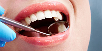 OPPSØK TANNLEGE: Dersom det iser i tennene kan det ha underleggende problemer. Foto: COLOURBOX