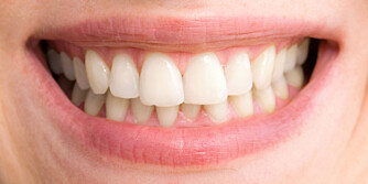 FLOTT SMIL: Uten de isende smertene smiler du lettere. Foto: COLOURBOX