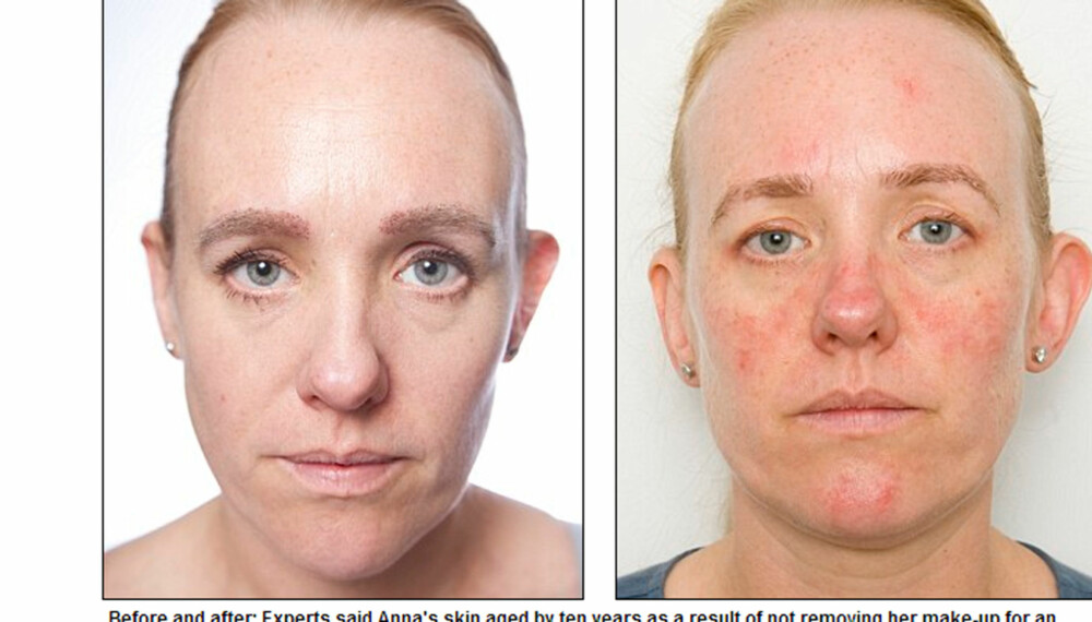 FØR OG ETTER: Eksperter mener at Anna Pursgloves hud har eldes med ti år som følge av ikke å fjerne sminken på en hel måned.