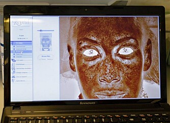 SCANNET: - Ved hjelp av 3D-kameraene kan man analysere aspekter av huden som man ikke kan se med det blotte øyet. Slike scannere forteller om porestørelse, solskader, rynkedybde, fuktighetsnevå, pigmenteringer og mye mer, samtidig som det gir deg mulighet til å reversere skade før den blir synlig, sier hudlege Rolah O. Lønning.