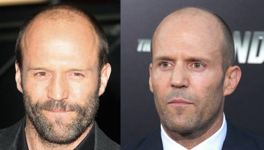 UTROLIG: Kun ett og et halvt år skiller disse to bildene av den kjente action-skuespilleren, Jason Statham, men han er faktisk yngre på bildet til venstre! Nok et bevis på at snauklipt eller barbert hår er best når man begynner å miste det.