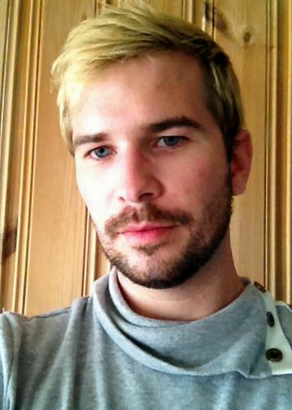 SLÅTT NED: Karl Magnus Nyeng ble i 2006 slått ned i Oslo fordi han er homofil. Han føler at politiet og helsevesenet ikke tok hans sak alvorlig. Foto: privat