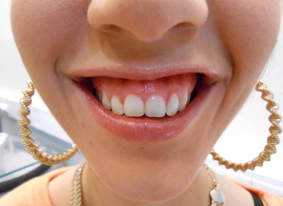 DET NATURLIGE SMILET: Slik ser Michelles naturlige smil ut.