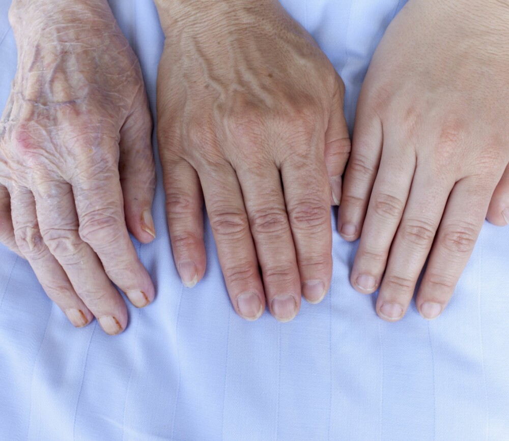 TYDELIGE TEGN: Behandling av hender kan man starte med så tidlig som mulig, for å forebygge aldringstegnene før de er blitt for tydelige.