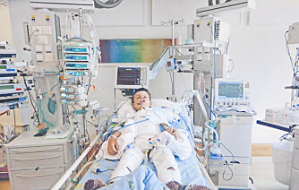 KOBLET TIL: Eros ligger i koma på Rikshospitalet. Legene visste ikke om han ville ha en hjerneskade når han våknet igjen. 