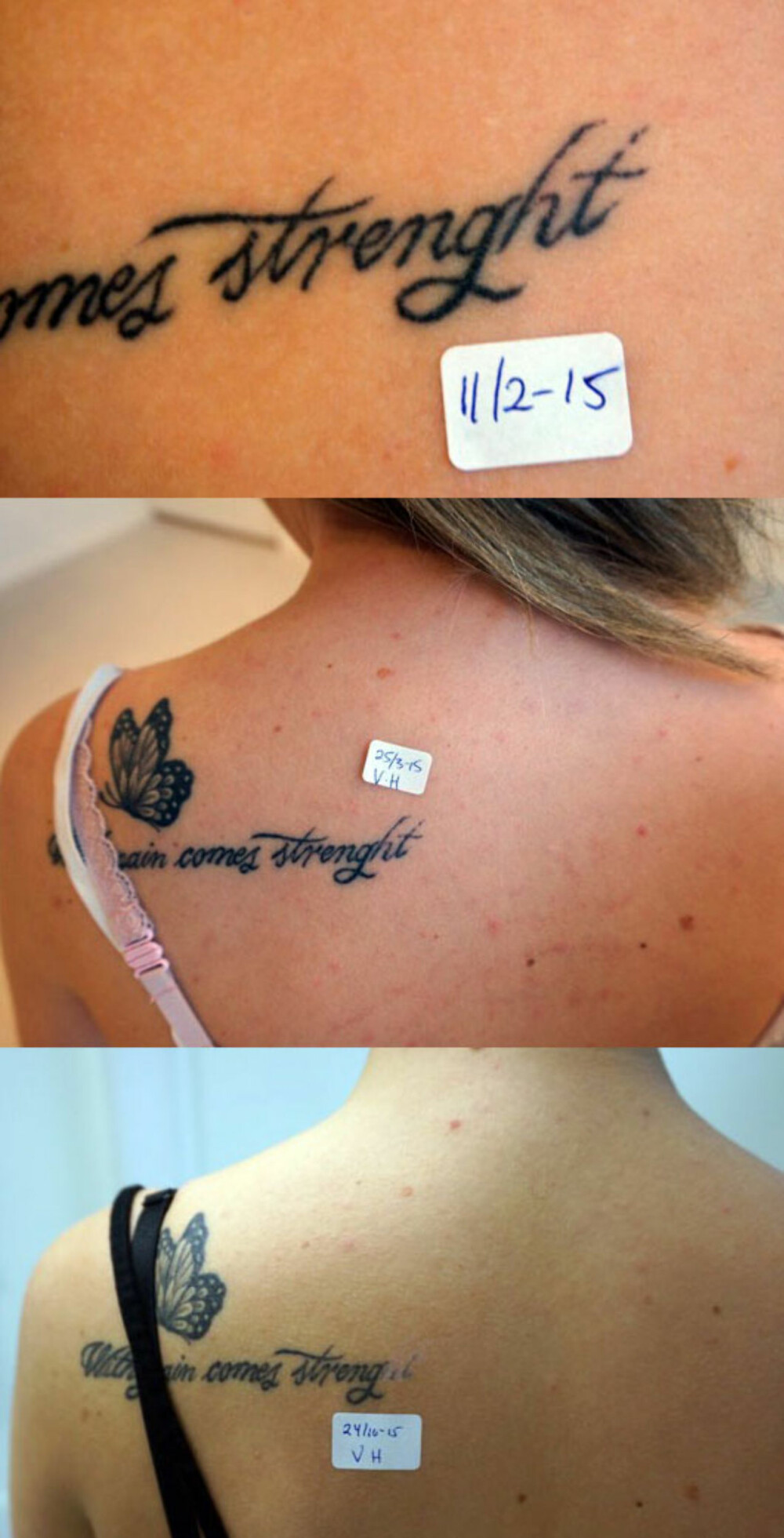 SKRIVELEIF: Det er ikke noe særlig å vandre rundt med skrivefeil på tatoveringen. Derfor var det naturlig for denne kvinnen å fjerne de to siste bokstavene for å kunne rette på tatoveringen igjen etterpå. Om du skulle lure; det skrives "strength", ikke "strenght".