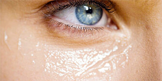 KJENDISTRIKS: For å stramme opp poser og løs hud under øynene, er det et velkjent triks å benytte seg av hemoroidekrem.