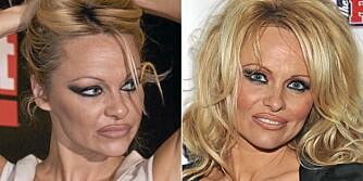 LIPLINER: Pamela Anderson har flere enn én gang brukt en litt for markant lipliner.