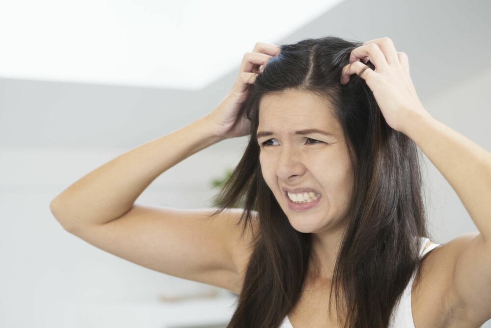 KLØE: En irritert hodebun kan være en plage fra morgen til kveld.