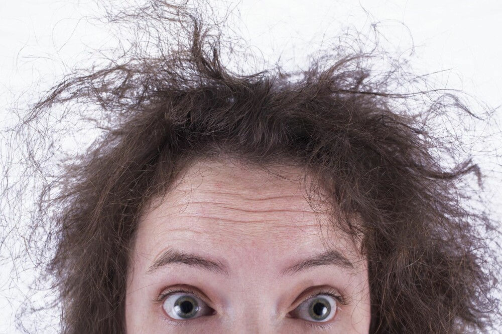 SKANDINAVISK HÅR: Tørt hår er et vanlig fenomen her i kalde norden!