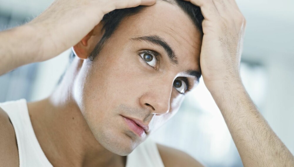 HÅRTAP: For de fleste menn begynner hårfestet å bli tynnere i 30-årene. Men mange opplever også å få en tynnere manke så tidlig som i tenårene.
