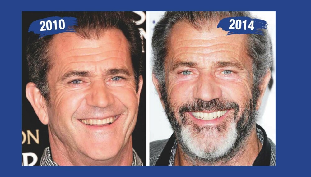 STOR FORANDRING: Det er stor forandring på tennene til Mel Gibson fra 2010 til 2014.