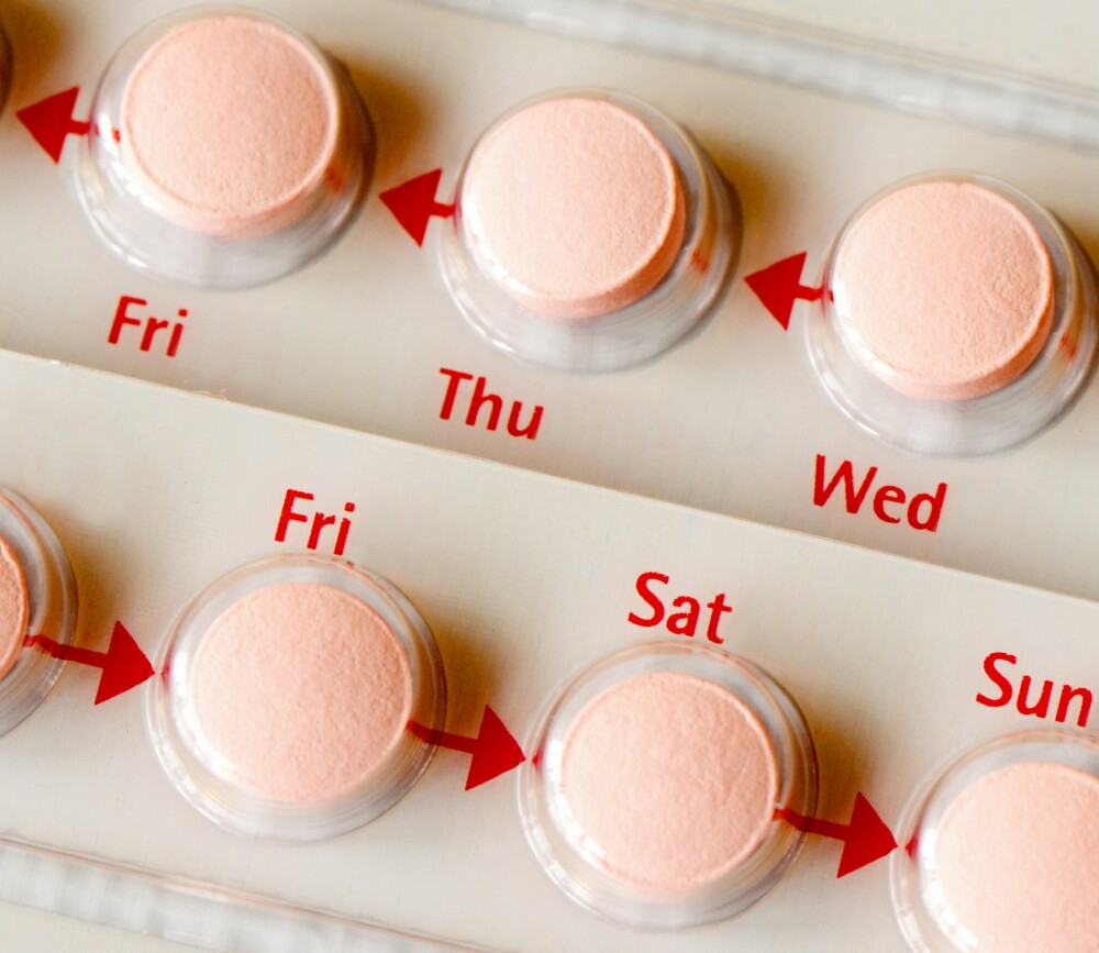 HUMØRSVINGNINGER: P-piller og nylig graviditet kan føre til hyperpigmenteringtilstanden kalt melasma.
