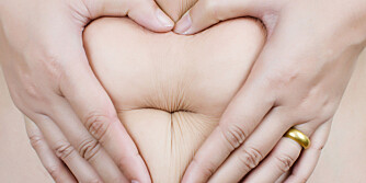 EKSTRA HUD: Overvekt eller graviditet kan gi overflødig hud på magen.