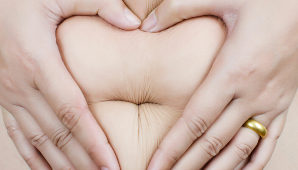EKSTRA HUD: Overvekt eller graviditet kan gi overflødig hud på magen.