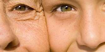 SENSITIV HUD: 70 prosent av oss har sensitiv hud.