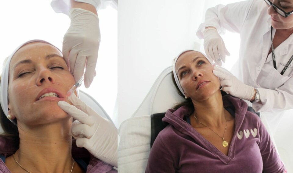 SPRØYTESTIKK: - Det kjennes litt ut som myggstikk, sa Elin om Restylane-stikkene. Men Botox-stikkene sved litt mer. Det hele var over på noen få minutter.