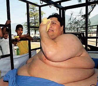 Det er slitsom å være så tjukk som Manuel Uribe. Han har veid opp mot et halvt tonn. Nå veier han «bare» 310 kilo.