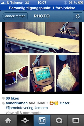 DELTE MED VENNER: Anne la ut bilder fra laserbehandlingen på Instagram. «AuAuAuAu!!», skriver hun under.