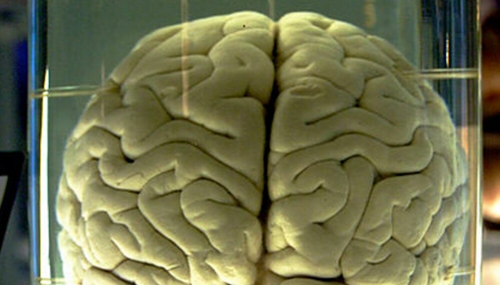 Dette er en sjimpanse-hjerne. Din er sikkert finere.