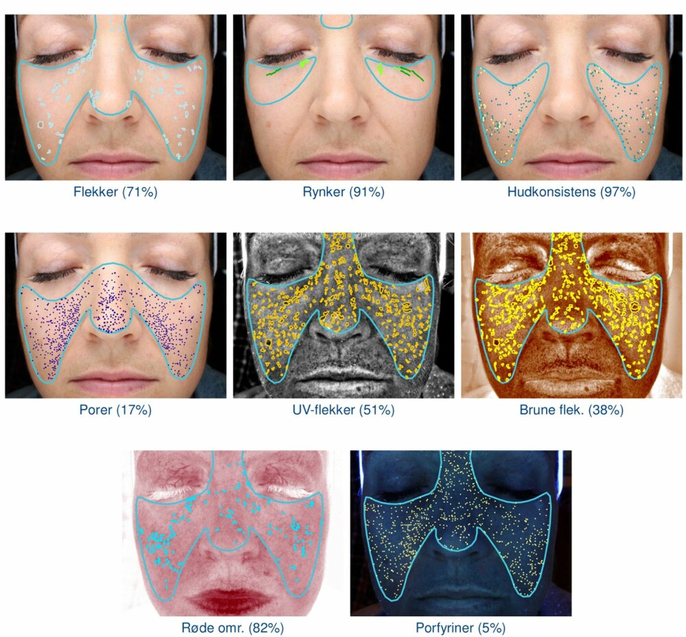 HUDANALYSE: Resultatene måles opp mot 100 andre kvinner på samme alder, og toppscore er 100 prosent. Her scorer jeg veldig bra på rynker og tekstur i huden (91 % og 97 %!), men porfyrin-nivået mitt og antall brune flekker og store porer er jo ganske katastrofalt....