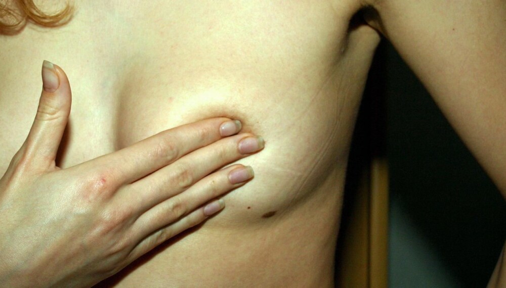 Har du et betent bryst, kan du prøve å håndpumpe det vonde brystet mens du tar en varm dusj. Foto: Colourbox