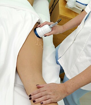 FJERNE CELLULITTER: En vanlig behandling som tilbys mot cellulitter i hudpleiesalonger, er lymfedrenasje med vakuum.