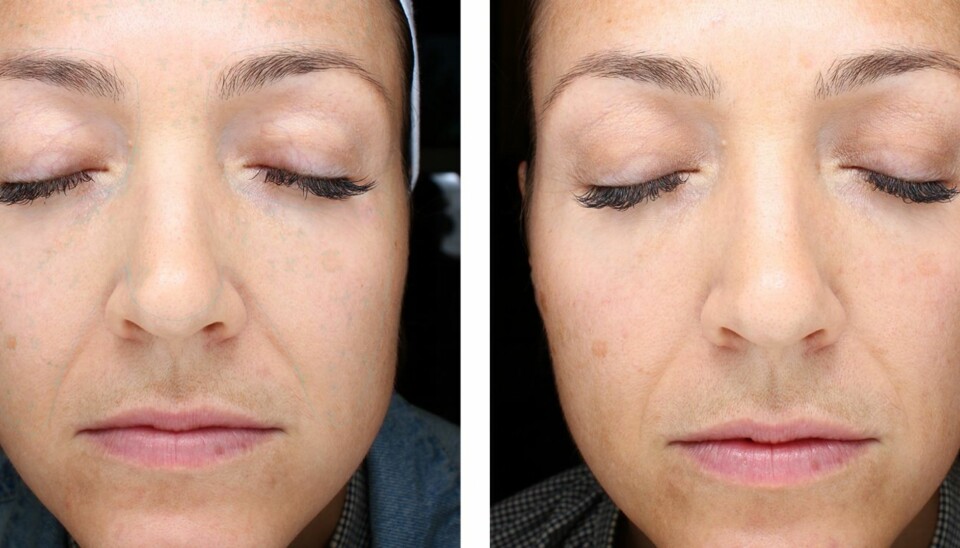 TEST AV POPULÆR HUDPLEIESERIE: Vi testet ZO Skin Health. Her er resultatet.
