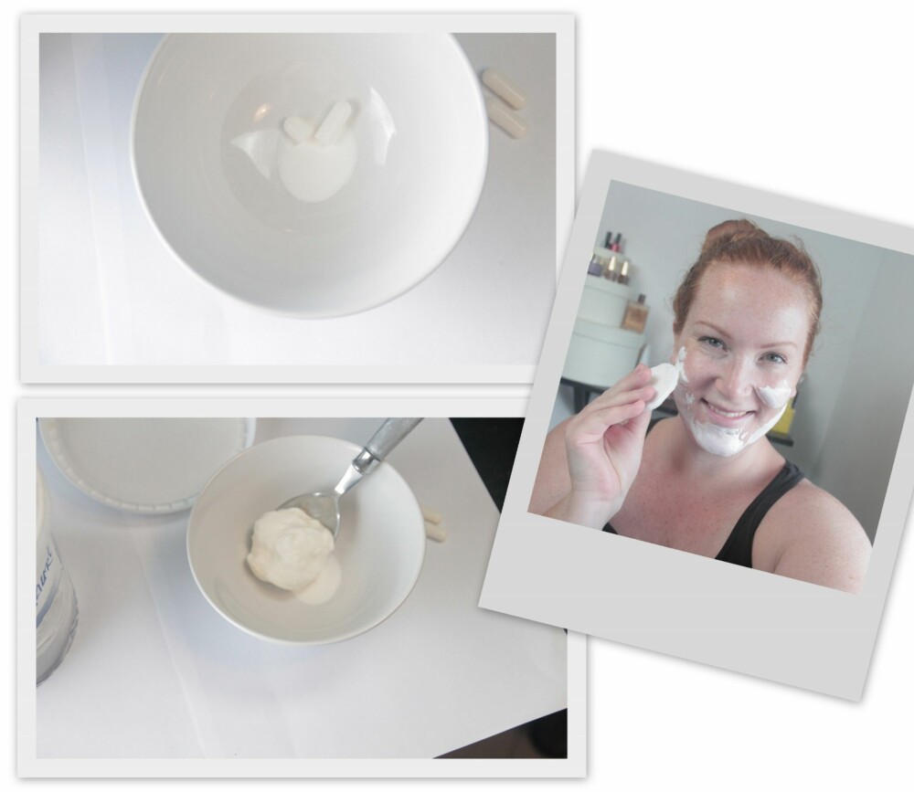 STEG FOR STEG: Åpne en Probiotika kapsel i en liten bolle, og tilfør ett par spiseskjeer med gresk yogurt. Etter Lauren sin oppskrift skal bomull brukes til påføring, men jeg synes ærlig talt det ville vært lettere med hendene. STEG FOR STEG: Åpne en Probiotika kapsel i en liten bolle, og tilfør ett par spiseskjeer med gresk yogurt. Etter Lauren sin oppskrift skal bomull brukes til påføring, men jeg synes ærlig talt det ville vært lettere med hendene.