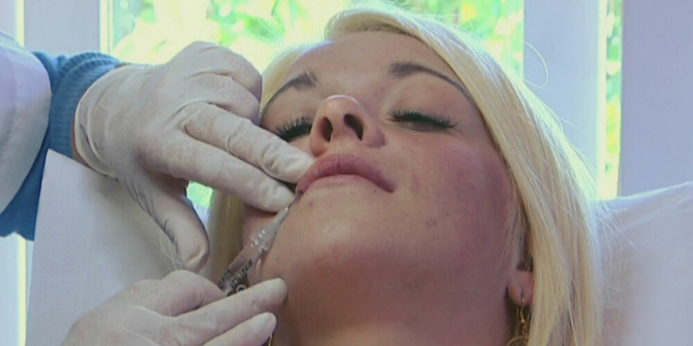 IKKE LENGER TABU: Nå skjuler vi ikke det lengre om vi har prøvd botox eller fillere. IKKE LENGER TABU: Nå skjuler vi ikke det lengre om vi har prøvd botox eller fillere.