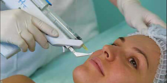 LASER: Flere og flere velger laser for å fjerne ansiktshåret permanent.