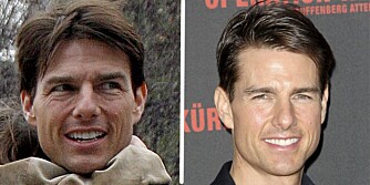 FRA RYNKETE TIL GLATT: En markant forandring på få måneder. Rynkene er borte og Tom Cruise ser plutselig svært så ung ut i ansiktet. Ryktene vil ha det til at han har fått hjelp av kirurgen.