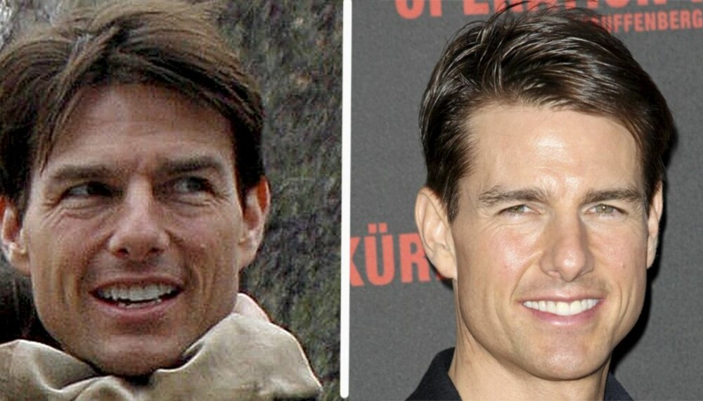 FRA RYNKETE TIL GLATT: En markant forandring på få måneder. Rynkene er borte og Tom Cruise ser plutselig svært så ung ut i ansiktet. Ryktene vil ha det til at han har fått hjelp av kirurgen.