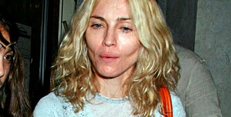 SLITER: Madonna sliter tydelig med helsen om dagen. Med slitne øyne og innsunkne kinn ser hun sykelig og gammel ut