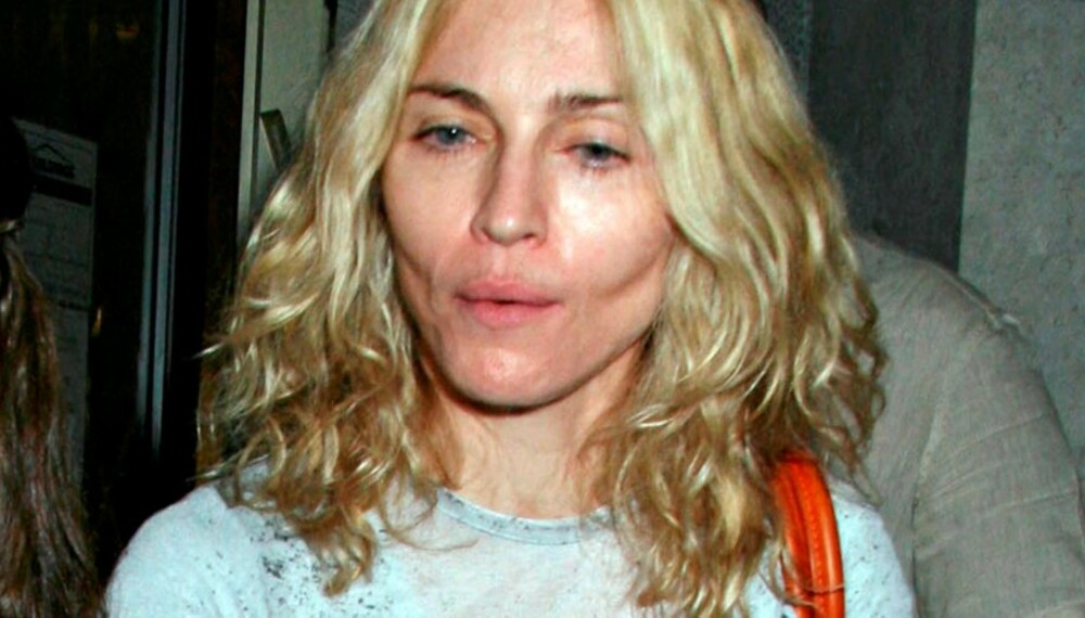 SLITER: Madonna sliter tydelig med helsen om dagen. Med slitne øyne og innsunkne kinn ser hun sykelig og gammel ut SLITER: Madonna sliter tydelig med helsen om dagen. Med slitne øyne og innsunkne kinn ser hun sykelig og gammel ut