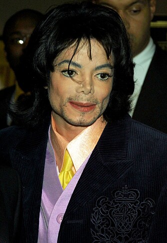 FORANDRET: I løpet av 90-tallet forandret Michael sitt utseende drastisk. Visstnok skal han lide av en sykdom som gjør huden hans hvit.
