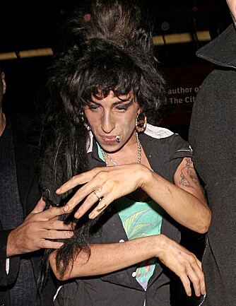 SYK: Amy Winehouse sliter med lungeemfysem. Trolig på grunn av hyppig røyking og bruk av dop.